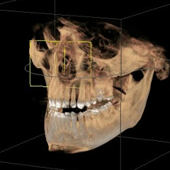 Michael Wagner, 01.01, Санкт-Петербург