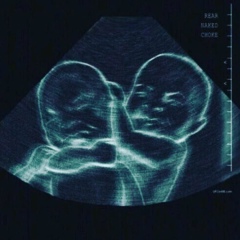 Ильяс Ильясовский, 03.01, Алматы