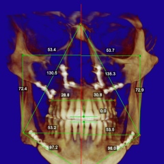 Лаврентий Федотов, 26.08, Москва
