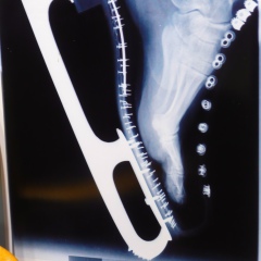 Солтан Кокоев, 03.03, Москва