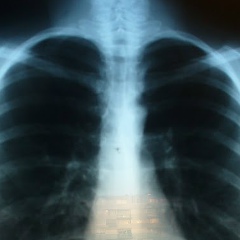 Виталия Хохлова, 13.09, Grenoble