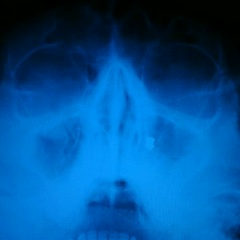 Cерёга Олейниченко, Челябинск