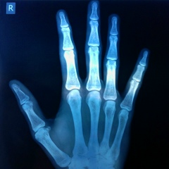 Вова Андрієнко