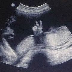 Айсана Рахымжанова, 12.02, Астана