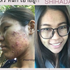 Nwe-Nwe-Thin Yu-Wai-Oo, 17.05.1986