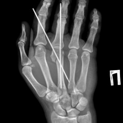 Александр Погребняк, 08.07.1985, Санкт-Петербург