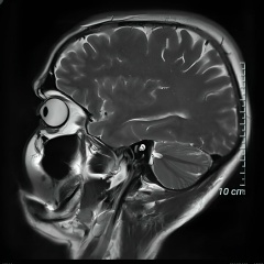 Оксана Нойкетер, 31.05.1990, Москва