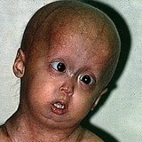 Радик Абазов, 18.12