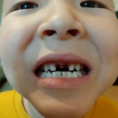 Нурбол Ербол, Алматы