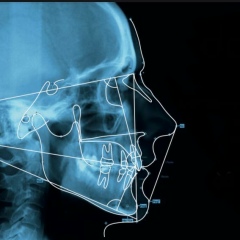 Арсен Шахаев, 05.12.1987, Махачкала