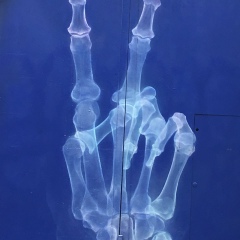 Наташа Лученцова, Харьков