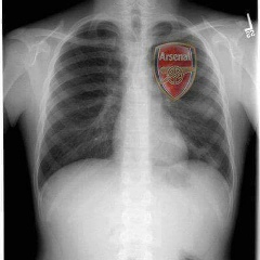 Mya San, 27.03.1975, Mandalay