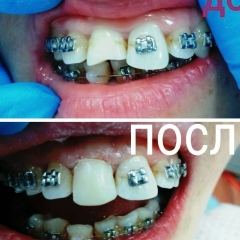 Белла Узденова, 03.12, Алматы