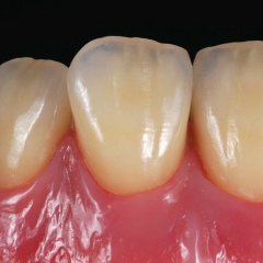 Амир Магомедов, 22.09.1986, Москва