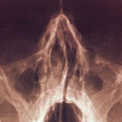 Алексей Абраменков, 04.08.1981, Москва