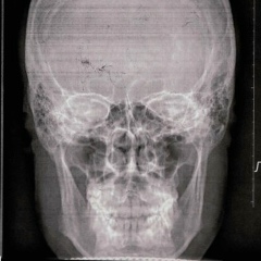 Илья Жирадков