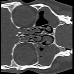 Роман Бакуменко, 08.08.1989