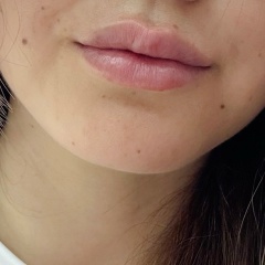 Олич Ли, 09.04.1987, Suwon