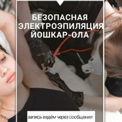 Удаление Волос-Навсегда, Йошкар-Ола