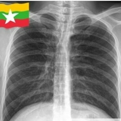 Lu U-Min, 08.12.1977, Naypyidaw