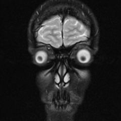 Андрей Закревский, 20.02, Стрельна